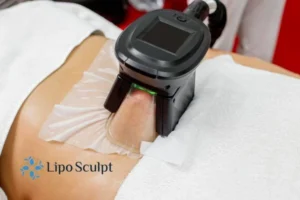 Are The Results From Aqualyx Permanent? 4 Compare Aqualyx Whitstable to other fat reduction treatments.