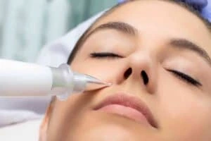 Best Actinic Keratoses Removal 3 Actinic keratoses Whitstable solutions - book in today!